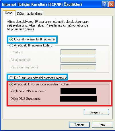 Windows DNS ayarı